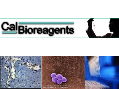 CalBioreagents代理，CalBioreagents上海代理，CalBioreagents北京代理，CalBioreagents 总代理，CalBioreagents一级代理，CalBioreagents试剂盒，CalBioreagents kit，CalBioreagents国内代理无锡四五零科技有限公司(四五零实验试剂)CalBioreagents专业_代理，具体产品信息欢迎电询：0510-85291432